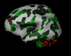 Lateral View Red=Low Expression11