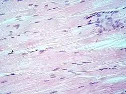 Muscle tissue, cell nuclei (blue-purple), cell body (pink)