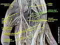 Deep palmar arterial arch