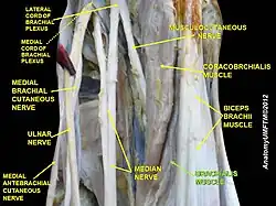 Brachialis muscle (labeled in green text)