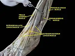 Muscles of leg (lateral view, deep dissection)