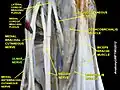 Brachial plexus with characteristic M, ulnar nerve labeled