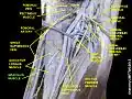 Gracilis muscle