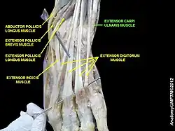 Extensor carpi ulnaris muscle
