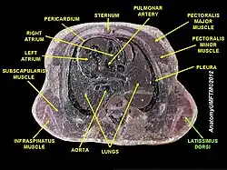 Latissimus dorsi